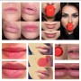 Уголемител за устни FULLLIPS